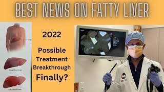 Best News On Treatment Of Fatty Liver Today, 2022