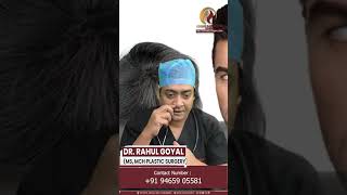 Why Hair Transplant is Difficult for Completely Bald People? | Dr. Rahul Goyal