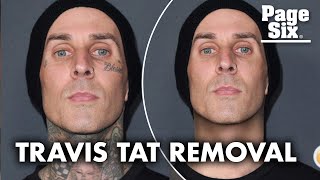 Travis Barker's 'Kourtney' tattoo erased in this ink-free makeover | Page Six Celebrity News