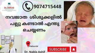 നവജാത  ശിശുക്കളിൽ പല്ലു  കണ്ടാൽ എന്തു ചെയ്യണം.#What to do if you see teeth in neonates#dr. Nabla's.