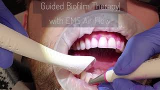 Guided Biofilm Therapy with EMS Airflow