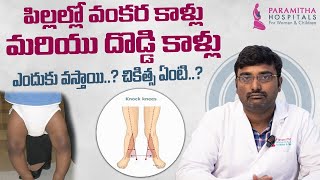 పిల్లల్లో వంకర కాళ్లు, దొడ్డి కాళ్లు | Knock Knees \u0026 Bow Legs Causes \u0026 Treatment |ParamithaHospitals