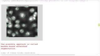 Watershed segmentation in Matlab