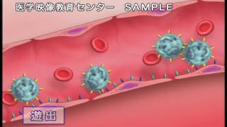 病気の基礎知識 病気の成因・病態の治療　Vol.9 免疫の領域