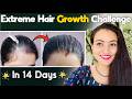 14 Days *Extreme Hair Growth* Challenge : Strongest Remedy to Grow Hair Faster, Longer & Thicker❤️