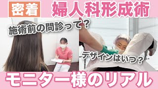 【密着】婦人科形成術を受けるきっかけと術後のリアル