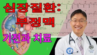 심장질환: 부정맥, LBBB, RBBB, Bifascicular block