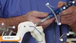 Dr  Burke Orthopedic - Robotic Surgery - Blue Belt Technology