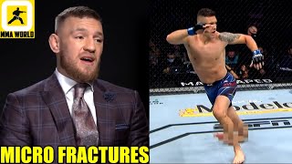 Conor McGregor reacts to Chris Weidman snapping his leg in half after throwing a calf kick,UFC 261