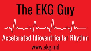 Accelerated Idioventricular Rhythm EKG l The EKG Guy - www.ekg.md