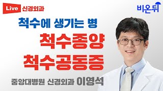 척수에 생기는 병: 척수종양, 척수공동증 (중앙대병원 신경외과 이영석)