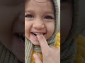 omg 😳 hat kat diya 😡😡😡 short video 🤣 viral funny baby yt ytshorts cute lol kidsvideo