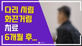 다리 시림 화끈거림? 말초신경병증 치료 6개월 후 변화