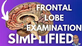 Best Structured Approach to Examine The Frontal Lobe - Neurological Examination