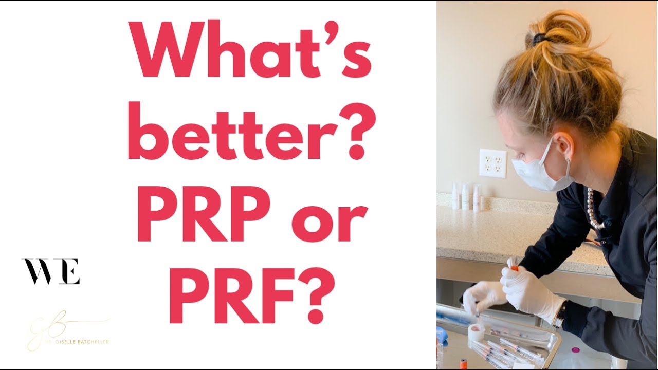Understanding The Differences Between Prp And Prf 56 Off