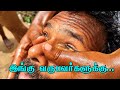 கொல்லிமலையில் நடந்த.... | Tamil nalam | iyarkai valviyal | massage therapy in india