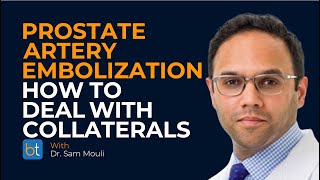 How to Deal with Collaterals in Prostate Artery Embolization | BackTable Clips