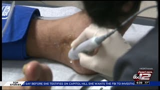 CDC: San Antonio's South Side has highest rates of amputations in Texas