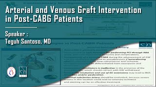 Arterial and Venous Graft Intervention in Post CABG Patients