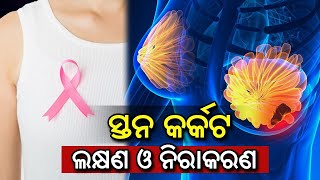 ସ୍ତନ କର୍କଟ ପାଇଁ ଅପରେସନ୍ କରିବା ଠିକ୍ କି ନୁହେଁ  Need of Surgery For Breast Cancer Dr. Krupasindhu Panda