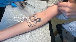 美國賽諾秀皮秒洗紋身#tattooremovalq#tattooremover #洗紋身#香港洗紋身#深圳洗紋身#皮秒洗紋身#tattooremoval#激光洗紋身#祛斑#洗纹身#澳門洗紋身#洗眉