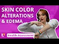 Skin Color Alterations & Edema - Health Assessment |@LevelUpRN