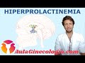 HIPERPROLACTINEMIA: Causas, telorrea, diagnóstico y tratamiento    - Ginecología y Obstetricia -