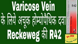 Best Medicine for Varicocele and Varicose Vein | Reckeweg R42 | Best Treatment of Varicocele/ r42