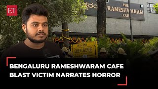 Bengaluru Rameshwaram Cafe blast victim narrates horror: 'I feel lucky to...'