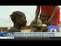 curbing malnutrition in turkana