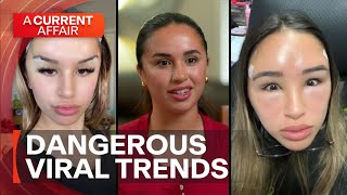 Influencer exposes dark side of social media beauty trends | A Current Affair