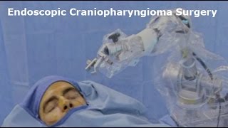 Surgeries   Craniopharyngioma Endoscopic Surgery