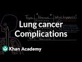 Lung cancer complications | Respiratory system diseases | NCLEX-RN | Khan Academy