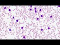 Hematopathology-Lymphoid-ALL.mp4