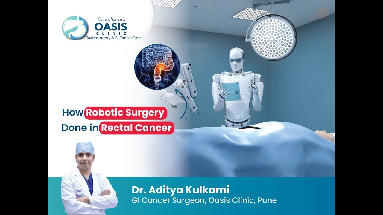 How Robotic Surgery Done In Rectal Cancer । Rectal Cancer । - Dr ...