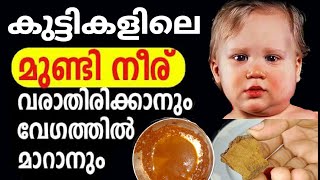 കുട്ടികളിലെ മുണ്ടിനീര് വളരേ വേഗത്തിൽ മാറ്റിയെടുക്കാം || Mumps Treatment Malayalam