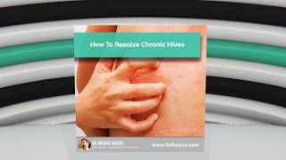 How to Resolve Chronic Hives – Audience Question