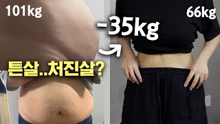 35키로 뺀 배는 얼마나 처질까? 튼살 처진살 있으면 어때🤨