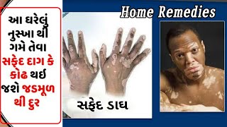 સફેદ ડાધ (કોઢ) | Home remedies for all skin Problems|The Review | Hitesh Sheladiya