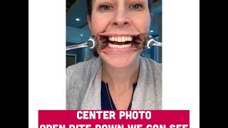 Virtual Orthodontic Consultation Front Open Photo