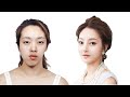 Top 5 Drastic Korean Plastic Surgery Tv Show Transformations | Seoul Guide Medical