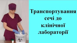 Транспортування сечі до клінічної лабораторії.