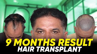 Hair Transplant in Mumbai | Best Results \u0026 Cost of Hair Transplant in Mumbai