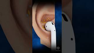 Why Your Earbuds Are Dirty 😨 Surgeon Reacts