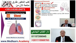 Pneumonia (II) #cme #internal_medicine #medical #usmle #محاضرات_باطنة