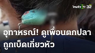 อุทาหรณ์! เด็กเล่นเบ็ดตกปลาเกี่ยวหัวเพื่อน | 30 เม.ย.67 | ข่าวเที่ยงไทยรัฐ