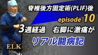 術後3週目　右脚に電撃痛が！職場のトイレがやばい