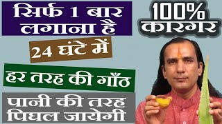 गांठ का रामबाण इलाज - How To Cure Lipoma by Sachin Goyal - ganth ka ilaj