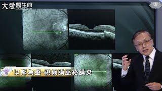 【大愛醫生館】以鄰為壑~視網膜脈絡膜炎 20221201