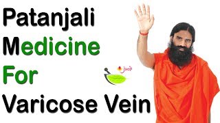 Patanjali Medicine for Varicose Vein | Patanjali Product for Varicose Vein | varicose vein patanjali